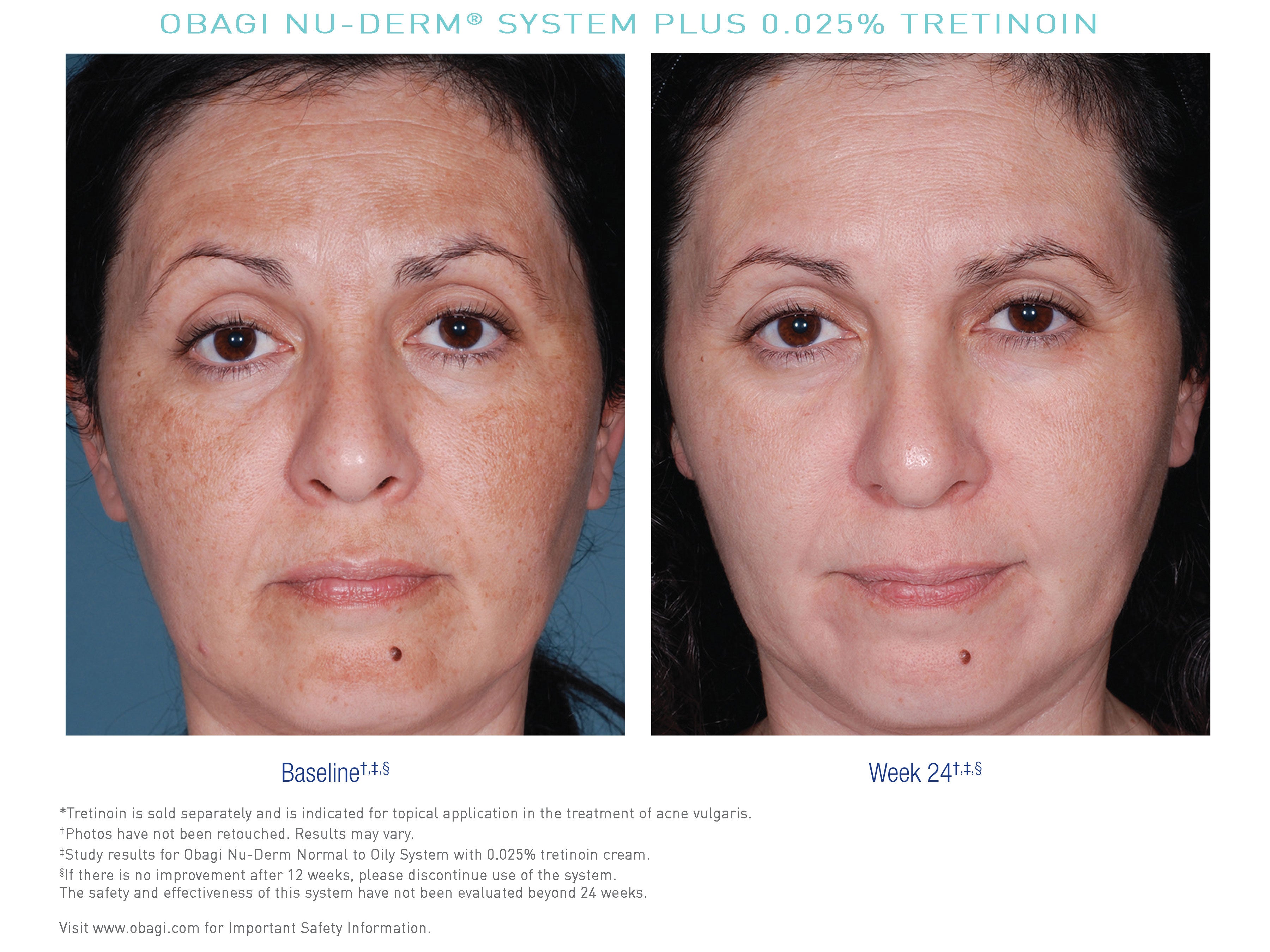 Confused about retinoids?
